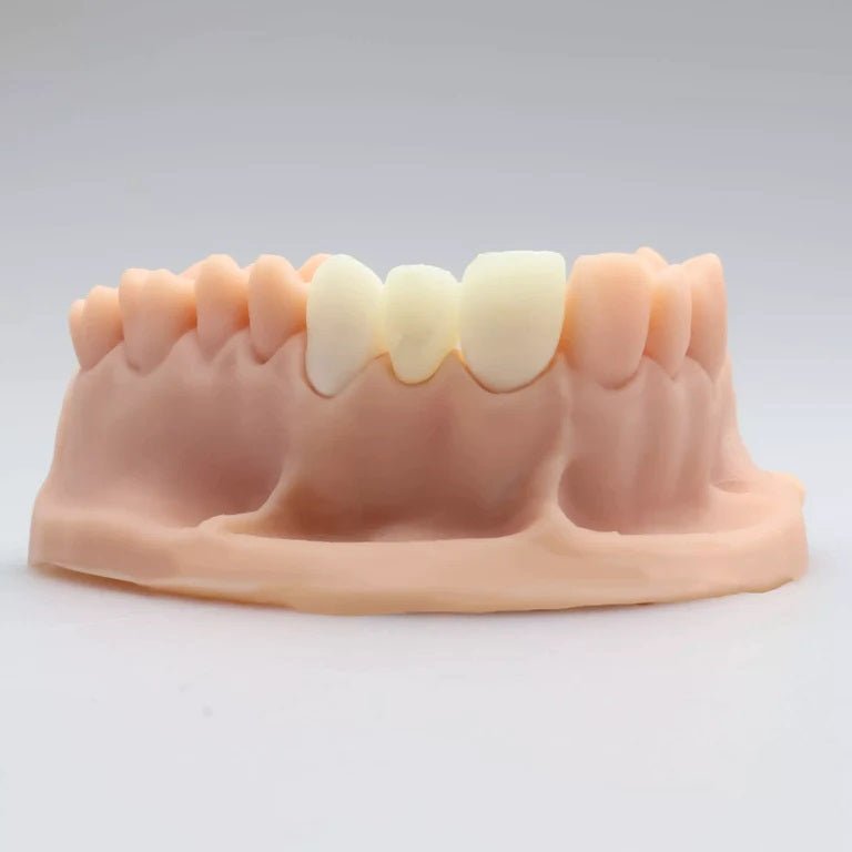 Alias - 3D Printer Resin for Dental Temp C&B - 1000 gr