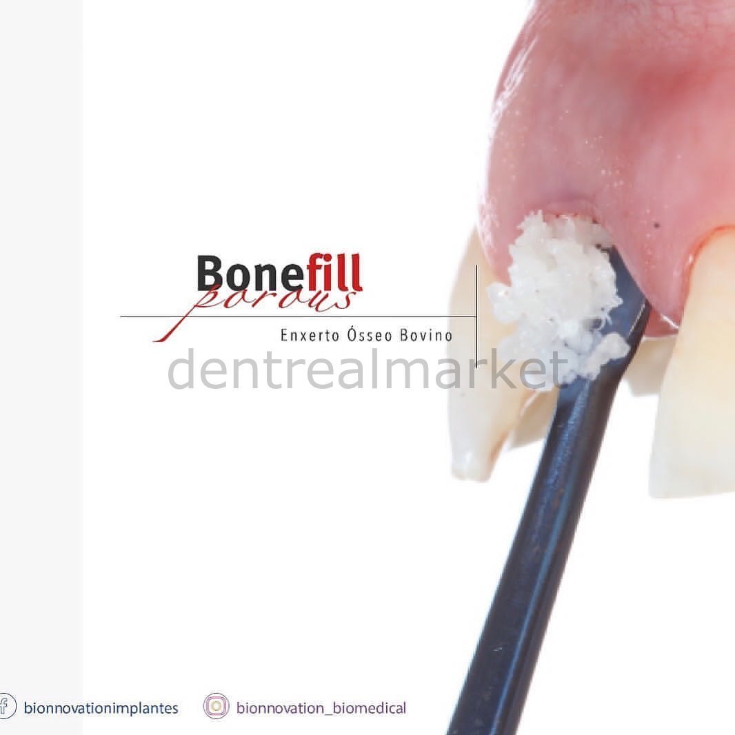 Bionnovation - Bonefill Prous (Cancellous) Bovine Graft - Xenograft - 5 gr (15cc)