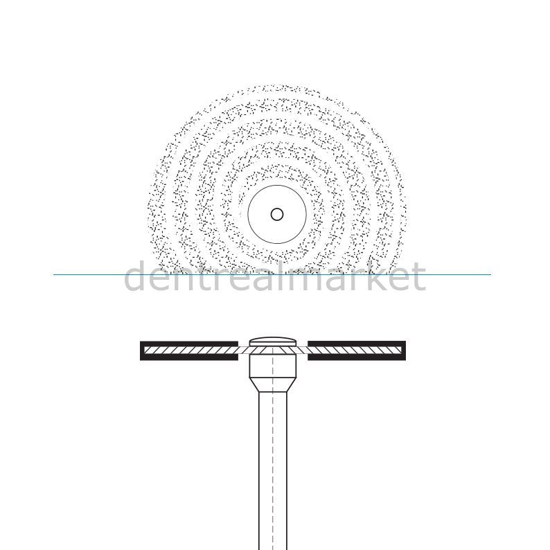 Frank Dental - Ortho Diamond Disc Interface Separe - Double Sided Etching