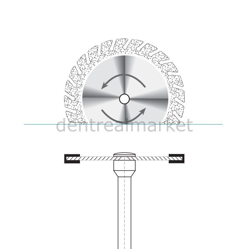 Frank Dental - Ortho Diamond Disc Interface Separe - Double Sided Etching