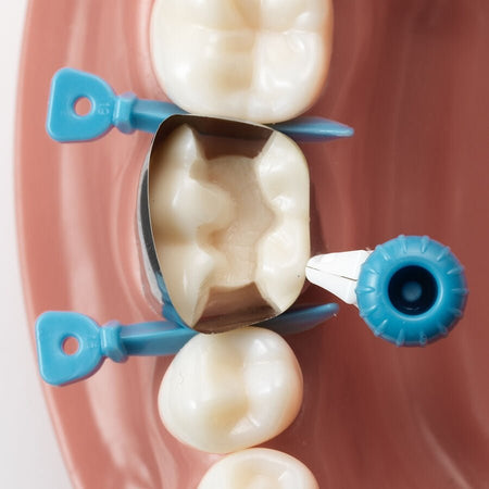 Dentsply - Sirona - Palodent 360 Circumferential Matrix System Kit