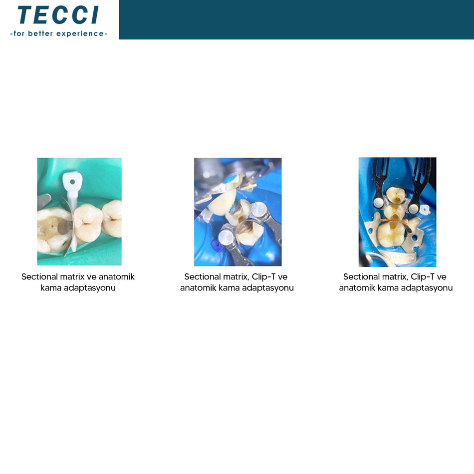 Tecci Regional Matrix Tape Stainless Steel - 400 Series