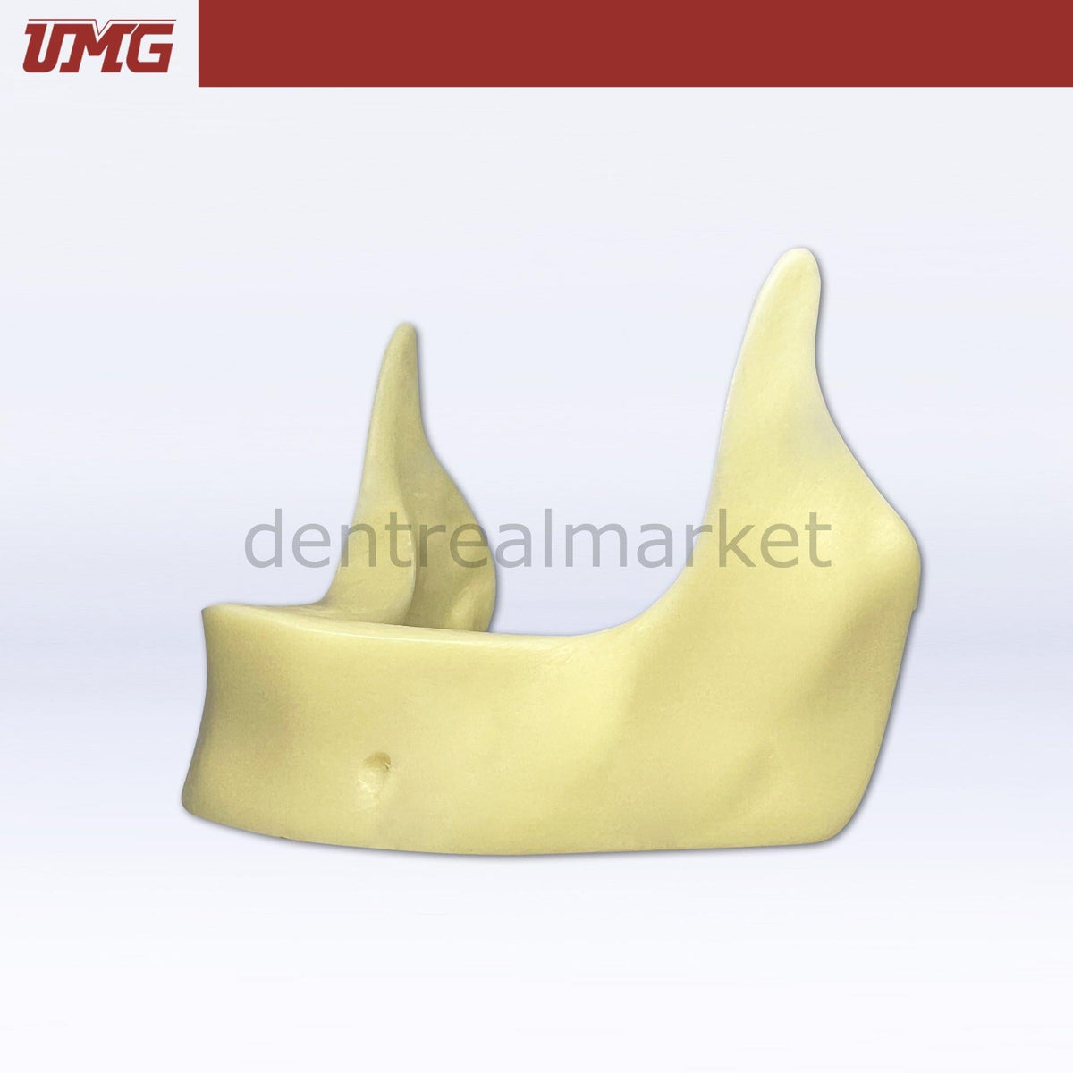 Umg Dental - Umg Model Implant Application Training Model - UM - Z2025