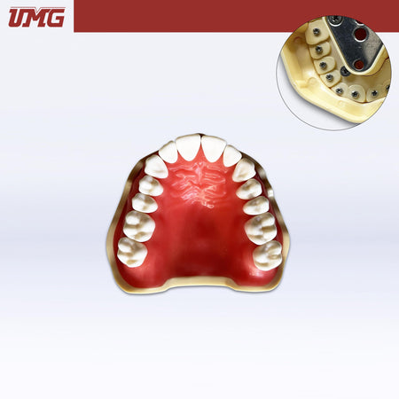 Umg Dental - Umg Model Removable Teeth Training Model Upper - Frasaco Compatible - UM - A2F